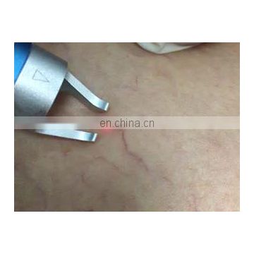 2019 vascular spider removal 980 nm laser beijing Anybeauty manufacturer
