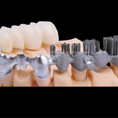 Digital-Crowns-Bridges Chinese Dental Lab Denture