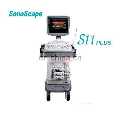 Original Sonoscape Color Doppler ultrasound S6 S8 S9 S11 S11 plus  S12 S22 S30 S40 S50 S50 elite/Sonoscape ultrasound