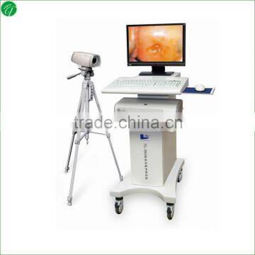 medical equipments trolley gynecological video colposcope for vagina