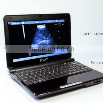 China Lightweight Full Digital Laptop Cheap Portable Ultrasound