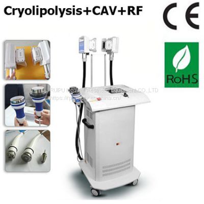 Cryolipolysis Cavitation RF beauty equipment