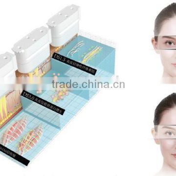 GLM Medical HIFU Wrinkle Removal Machine Results Facial Treatment Machines Last 3 Years High Frequency Machine For Face