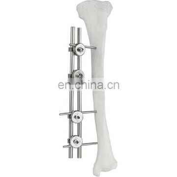 Factory Price Orthopedic Surgical Instruments Femur & Tibial External Fixator Orthopedic Surgical Implant Bone Surgery Fixation
