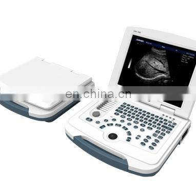 High quality notebook B/W  pregnancy diagnosis black and white ultrasound scanner