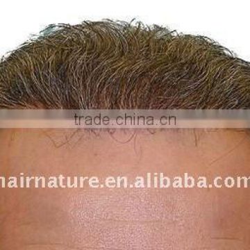 stock thin skin toupee