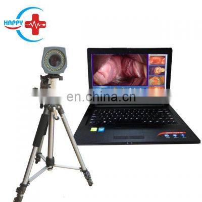 HC-F001 Cost effective Laptop Digital Video Colposcope for Gynecology/Portable Video Colposcope