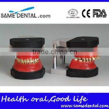 Dental orthodontic operational training model DEA-32