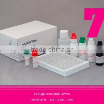 medical diagnostic reagent Hepatitis E virus Antibody IgG ELISA Kit HEV