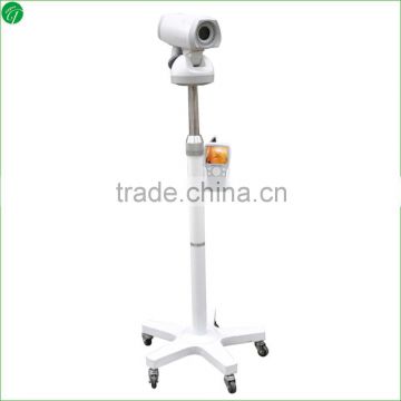 Video colposcope for gynecology price