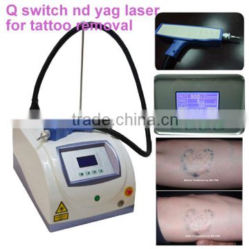Brown Age Spots Removal Nd Yag Laser Tattoo Removal Machine For Unwanted Tattoo And Pigmentation Marks Mongolian Spots Removal