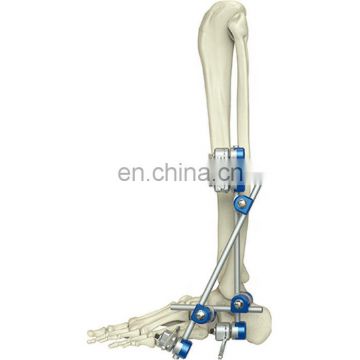 Competitive Price Instrument Orthopedic Ankle Joint External Fixator Orthopedic Surgical Implant Medical Instruments