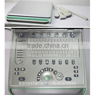 SS-10Plus 4D Laptop Ultrasound Scan