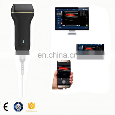 Mobile USB smart color doppler handheld ultrasound scanner medical wireless ultrasound probe