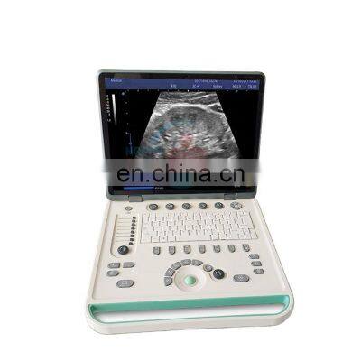 HC-A006A Hot Sale 15inch full digital portable PC Laptop 3D Ultrasound scanner machine price