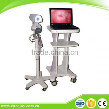 Portable Digital Electronic Colposcope RCS-500 for cervical erosion