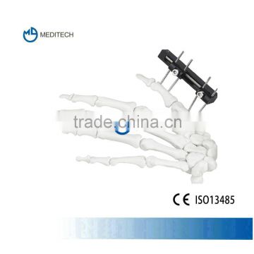 Orthofix Mini External Fixation orthopedic surgical instruments Type F