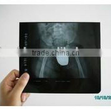 Manufacturer of medical x ray film,radiological dry film with CE,KND-A/F,used on fuji and agfa printers