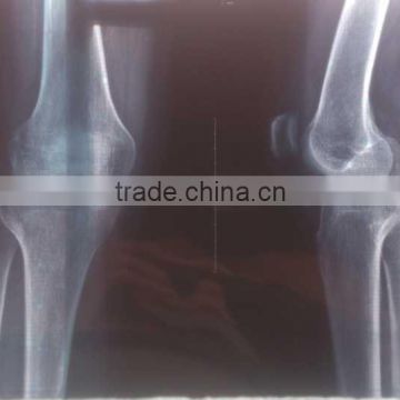 China medical x ray image CE KND film
