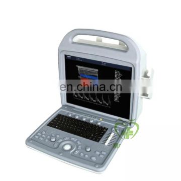 MY-A027 Portable laptop 3D Color Doppler Portable B Ultrasound Scanner