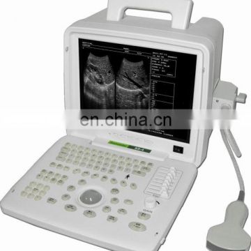 Portable black and white 12 inches LCD screen ultrasound machine for sale