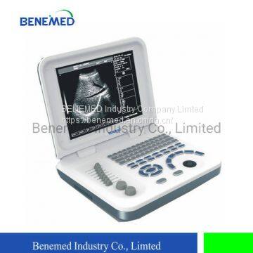Notebook Type Black and White Ultrasound Scanner