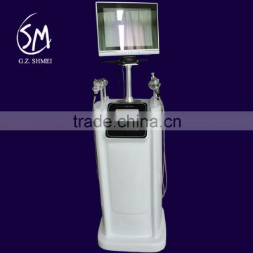Acne Removal China Supplier Special Facial E Light Ipl Rf Machine Shrink Trichopore