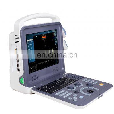 Hot selling 12 inch color ultrasound doppler machine for clinic and home use