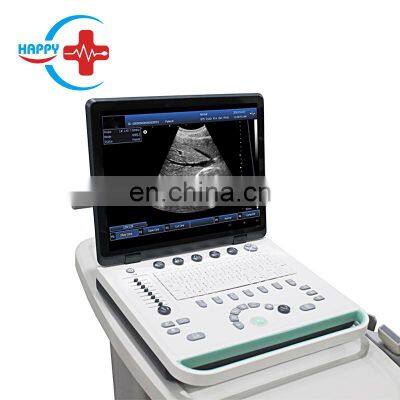 HC-A006B Laptop ultrasound machine portable ultrasound scanner ARM system