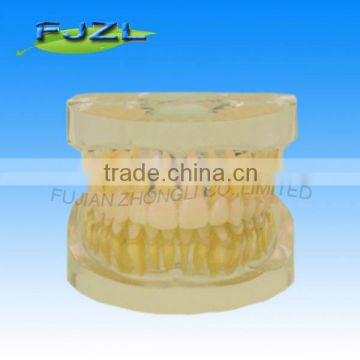 Dental Tooth Extraction Training Model