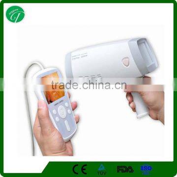 Medical digital video colposcope camera for surgery vagina examination/China electronic colposcope