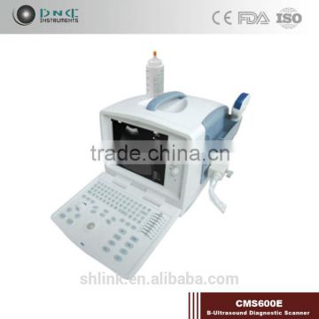 top grade hotsale link Digital Non-Interlaced portable ultrasound scanner 200D with low price