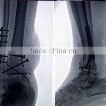 medical thermal x ray film of medical supplies store,hot laminating film thermal laminating film xx