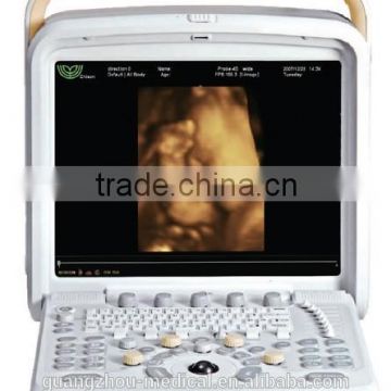 MC-DU-Q8 High Class Portable OB/GYN 3D/4D Cardiac Color Doppler Ultrasound Scanner