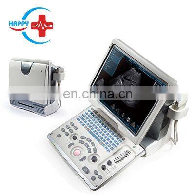 Cheapest Original Mindray DP-50  ultrasound portable ultrasonic diagnosis system/mindary ultrasound