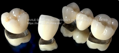 Ultra Hard Veneer All-Ceramic Crown Polishing Implant Dentures Dental