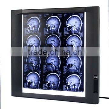 Ultra thinner medical film viewer radiology equipment