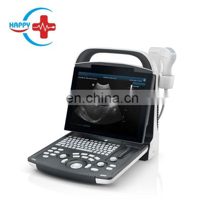 mindray dp 20 full digital LED medical ultrasound instruments ultrasound scanner