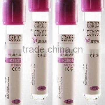 EDTA K2 vacuum blood collection tube