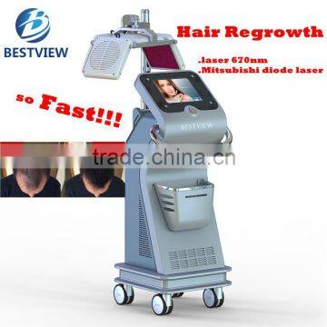 2017 Hot laser treatment for hair regrowth 670nm hair regrowth with mitsubishi diodes