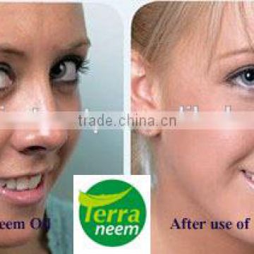 NEEM OIL PURE AND NATURAL