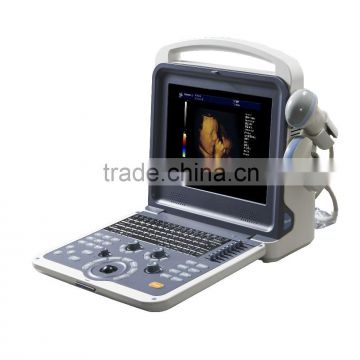 Portable Ultrasound Color Doppler with Competitive Price K6