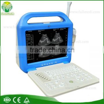 FM-3000B Portable Ultrasonic Diagnostic Devices for Human Use