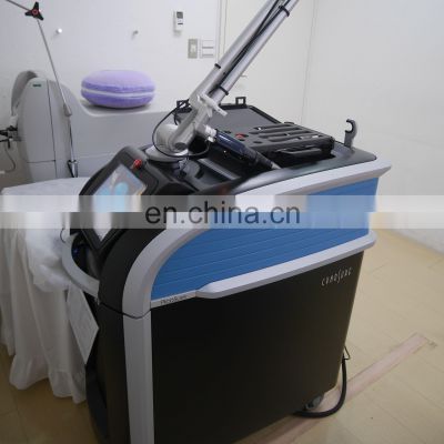 pico laser 2000mj carbon peel tattoo removal beauty machine