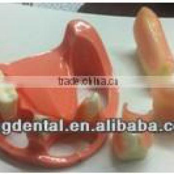 Hot sale and high quality Implant practice model AC-P22