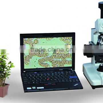 laptop nailfold microcirculation equipment with ce