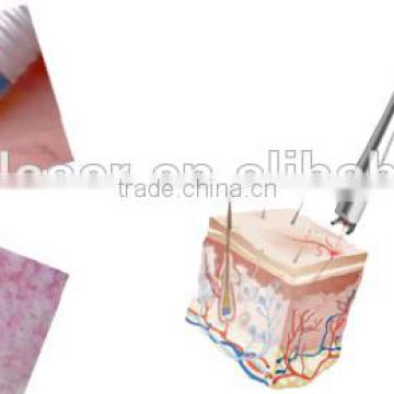 Hot Sale 980nm diode laser Red blood treatment