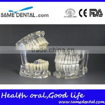 Dental standard transparent dentition model DEA-46