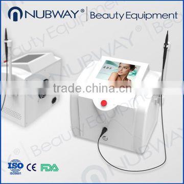30MHz Spider veins removal machine for red blood silk removal,angeioma removal