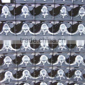 Imaging medical ray film,digital x-ray cr,fuji x-ray film sale from factory